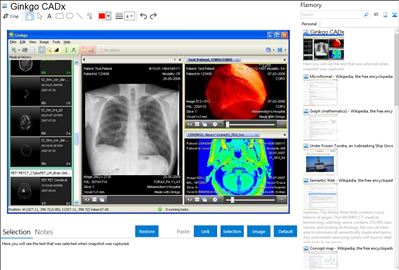 Ginkgo CADx - Flamory bookmarks and screenshots
