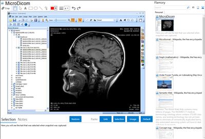 MicroDicom - Flamory bookmarks and screenshots